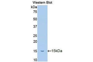 Western Blotting (WB) image for anti-Trefoil Factor 2 (TFF2) antibody (Biotin) (ABIN1173512)