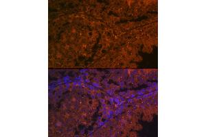Immunofluorescence analysis of mouse kidney using  Rabbit pAb (ABIN6131167, ABIN6136429, ABIN6136430 and ABIN6216480) at dilution of 1:100 (40x lens).
