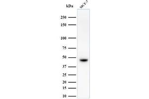 Western Blot Analysis of MCF-7 cell lysate using Cytokeratin, HMW Mouse Monoclonal Antibody (34BE12). (Cytokeratin 2 antibody)