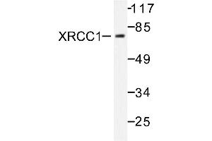Image no. 1 for anti-X-Ray Repair Complementing Defective Repair in Chinese Hamster Cells 1 (XRCC1) antibody (ABIN271979) (XRCC1 antibody)