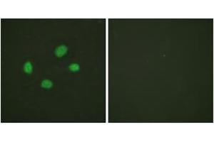 Immunofluorescence analysis of HeLa cells, using Chk2 (Phospho-Thr383) Antibody. (CHEK2 antibody  (pThr383))