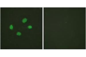 Immunofluorescence analysis of HeLa cells, using Chk2 (Phospho-Thr383) Antibody.