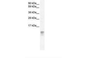 Image no. 2 for anti-Fatty Acid Binding Protein 3, Muscle and Heart (FABP3) (AA 46-95) antibody (ABIN202026) (FABP3 antibody  (AA 46-95))