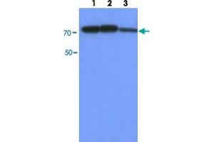 Western blot analysis of HepG2 cell lysate (30 ug) by using PFKM monoclonal antibody, clone AT2F11  (1:500-1:2000). (PFKM antibody  (AA 1-780))