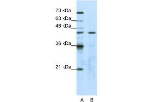 WB Suggested Anti-GTPBP9 Antibody Titration:  1. (OLA1 antibody  (N-Term))