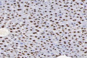 Immunohistochemistry analysis of paraffin-embedded mouse liver using,SET (ABIN7075583) at dilution of 1: 10000 (SET/TAF-I antibody)