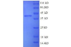 SDS-PAGE (SDS) image for Brain-Derived Neurotrophic Factor (BDNF) (AA 137-237), (partial) protein (GST tag) (ABIN1046634)