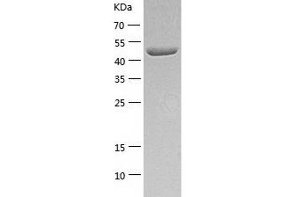 ALDH3A1 Protein (AA 1-453) (His tag)