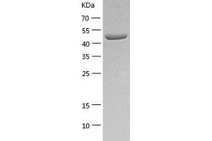 Western Blotting (WB) image for Aldehyde Dehydrogenase 3 Family, Member A1 (ALDH3A1) (AA 1-453) protein (His tag) (ABIN7121774) (ALDH3A1 Protein (AA 1-453) (His tag))