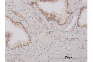 Immunoperoxidase of monoclonal antibody to FOXO3A on formalin-fixed paraffin-embedded human prostate. (FOXO3 antibody  (AA 361-460))