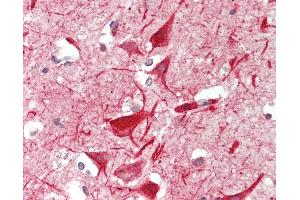 Human Brain, Cortex: Formalin-Fixed, Paraffin-Embedded (FFPE) (METTL13 antibody  (AA 650-700))