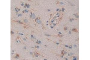 Used in DAB staining on fromalin fixed paraffin- embedded brain tissue (MPI antibody  (AA 2-423))