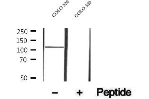 Western blot analysis of extracts of COLO 320 cells, using p107 antibody.