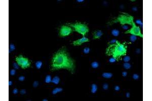 Immunofluorescence (IF) image for anti-Katanin P80 (WD Repeat Containing) Subunit B 1 (KATNB1) antibody (ABIN1498987) (KATNB1 antibody)