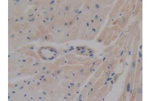Detection of ABCA1 in Mouse Heart Tissue using Polyclonal Antibody to ATP Binding Cassette Transporter A1 (ABCA1) (ABCA1 antibody  (AA 1404-1663))