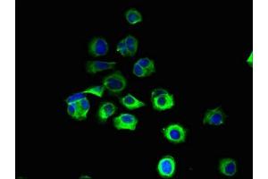 Immunofluorescent analysis of MCF-7 cells using ABIN7151123 at dilution of 1:100 and Alexa Fluor 488-congugated AffiniPure Goat Anti-Rabbit IgG(H+L) (RNF13 antibody  (AA 432-685))