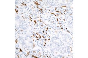 Immunohistochemistry (IHC) image for anti-CD163 (CD163) (AA 850-900) antibody (ABIN7448890) (Recombinant CD163 antibody  (AA 850-900))