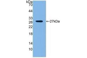 Detection of Recombinant LOXL1, Mouse using Polyclonal Antibody to Lysyl Oxidase Like Protein 1 (LOXL1) (LOXL1 antibody  (AA 392-598))