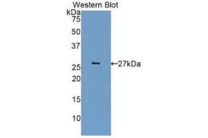 Detection of Recombinant CDK5, Human using Monoclonal Antibody to Cyclin Dependent Kinase 5 (CDK5) (CDK5 antibody  (AA 92-273))