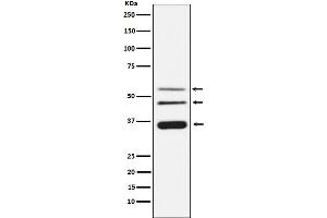 Western Blotting (WB) image for anti-Legumain (LGMN) antibody (ABIN7607042)