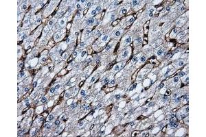 Immunohistochemical staining of paraffin-embedded liver tissue using anti-CD36mouse monoclonal antibody. (CD36 antibody)
