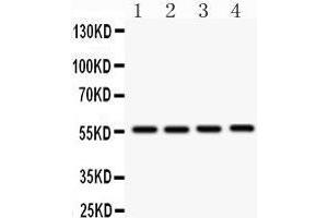 Anti- SMAD3 Picoband antibody, Western blotting All lanes: Anti SMAD3  at 0.