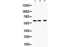 Western blot analysis of TCP1 theta expression in rat brain extract ( Lane 1), mouse brain extract ( Lane 2) and U20S whole cell lysates ( Lane 3). (CCT8 antibody  (AA 421-548))
