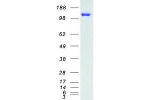 Western Blotting (WB) image for Lysine (K)-Specific Demethylase 4C (KDM4C) protein (Myc-DYKDDDDK Tag) (ABIN2723934)