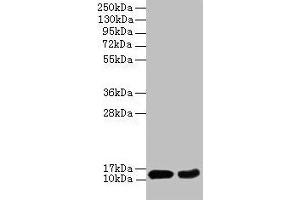 Western blot All lanes: EIF4EBP2 antibody at 2 μg/mL Lane 1: Mouse heart tissue Lane 2: NIH/3T3 whole cell lysate Secondary Goat polyclonal to rabbit IgG at 1/10000 dilution Predicted band size: 13 kDa Observed band size: 13 kDa (eIF4EBP2 antibody  (AA 1-120))