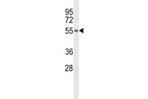 Western blot analysis of TSPY antibody pre-incubated without (Lane 1) and with (2) blocking peptide in LNCAP lysate. (TSPY1 antibody  (AA 274-303))