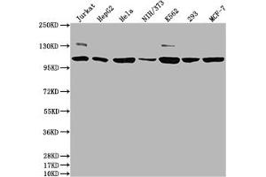 Western Blot Positive WB detected in: Jurkat whole cell lysate, HepG2 whole cell lysate, Hela whole cell lysate, NIH/3T3 whole cell lysate, K562 whole cell lysate, 293 whole cell lysate, MCF-7 whole cell lysate All lanes: PIK3CA antibody at 1:1500 Secondary Goat polyclonal to rabbit IgG at 1/50000 dilution Predicted band size: 125 kDa Observed band size: 110 kDa (Recombinant PIK3CA antibody  (Catalytic Subunit alpha))