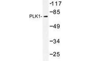 Western blot analysis of PLK1 antibody in extracts from 293 cells. (PLK1 antibody)