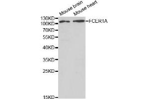 Western blot analysis of extracts of mouse brain and mouse heart cell lines, using FCER1A antibody. (Fc epsilon RI/FCER1A antibody)