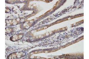 Image no. 1 for anti-Translocase of Inner Mitochondrial Membrane 9 (TIMM9) (AA 1-90) antibody (ABIN599211) (TIMM9 antibody  (AA 1-90))