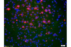Formalin-fixed and paraffin-embedded rat brain labeled with Anti-ACTH (1-39) Polyclonal Antibody, Unconjugated (ABIN668676) 1:200, overnight at 4°C, The secondary antibody was Goat Anti-Rabbit IgG, Cy3 conjugated used at 1:200 dilution for 40 minutes at 37°C. (ACTH antibody  (AA 1-39))