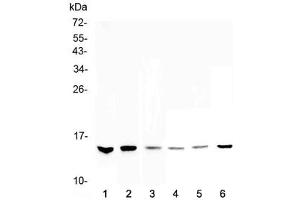 Western blot testing of 1) human HeLa, 2) human MDA-MB-231, 3) human MDA-MB-451, 4) rat thymus, 5) mouse testis and 6) mouse thymus lysate with HE4 antibody at 0.
