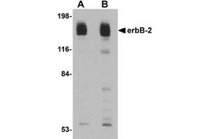 Western Blotting (WB) image for anti-Receptor tyrosine-protein kinase erbB-2 (ErbB2/Her2) (C-Term) antibody (ABIN1030383) (ErbB2/Her2 antibody  (C-Term))
