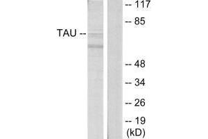 Western blot analysis of extracts from HeLa cells, using Tau (Ab-396) antibody. (MAPT antibody  (Ser396))