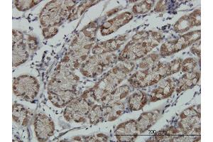 Immunoperoxidase of monoclonal antibody to RPS6KA6 on formalin-fixed paraffin-embedded human stomach. (RPS6KA6 antibody  (AA 636-745))