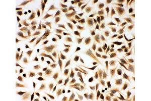 ICC testing of Smad2 antibody and HeLa cells (SMAD2 antibody  (N-Term))