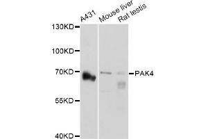 Western blot analysis of extracts of various cell lines, using PAK4 Antibody (ABIN5971470) at 1:3000 dilution. (PAK4 antibody)