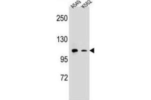 Western Blotting (WB) image for anti-Integrin alpha M (ITGAM) antibody (ABIN2995765)