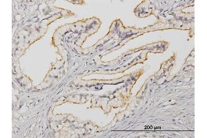 Immunoperoxidase of monoclonal antibody to APOB48R on formalin-fixed paraffin-embedded human prostate. (APOBR antibody  (AA 71-170))