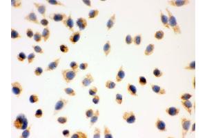 Immunohistochemistry (IHC) image for anti-Hydroxysteroid (17-Beta) Dehydrogenase 10 (HSD17B10) (AA 48-261) antibody (ABIN3042460)