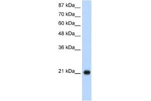 WB Suggested Anti-RPL9 Antibody Titration:  1. (RPL9 antibody  (C-Term))