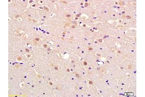 Formalin-fixed and paraffin embedded rat brain labeled with Anti-APEX2 Polyclonal Antibody, Unconjugated (ABIN718481) at 1:200 followed by conjugation to the secondary antibody and DAB staining (APEX2 antibody  (AA 301-400))
