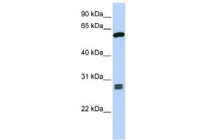 WB Suggested Anti-ACD Antibody Titration: 0. (ACD antibody  (C-Term))
