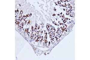 Immunohistochemistry of paraffin-embedded rat testis using P antibody (ABIN7269446) at dilution of 1:100 (40x lens). (PABP antibody  (AA 350-450))