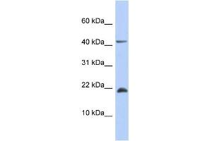 WB Suggested Anti-SFRS12IP1 Antibody Titration: 0.