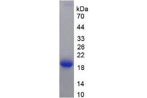 SDS-PAGE (SDS) image for Keratin 12 (KRT12) (AA 398-456) protein (His tag) (ABIN1170811)